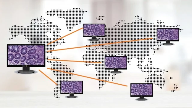 پاتولوژی از راه دور